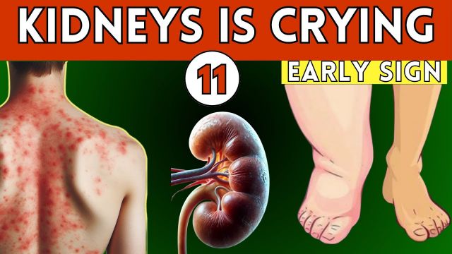 11 Alarming Signs Your Kidneys Are Crying for Help—Don’t Ignore These Warnings!